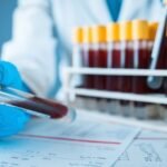 Therapeutic Drug Monitoring by bhavyagyan
